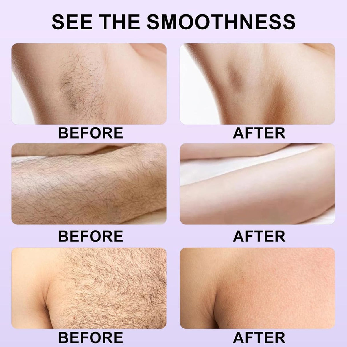 BareBliss™ - Body Hair Removal Cream